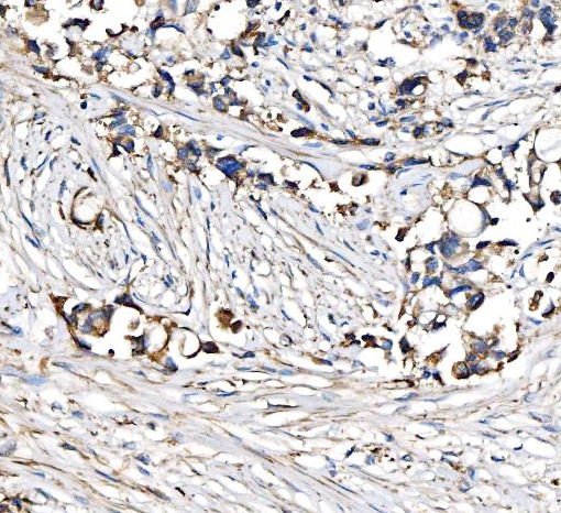  IHC analysis of CPT1A using anti-CPT1A antibody (A00917-3)