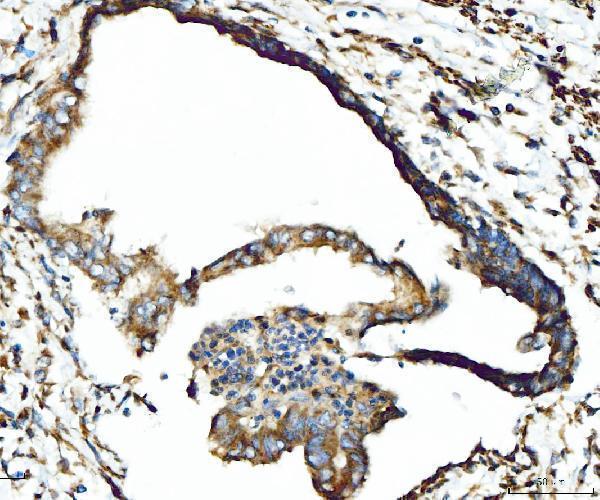 a00917 3 cpt1a primary antibodies ihc testing 4