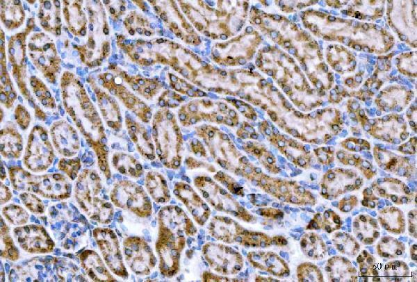 a00917 3 cpt1a primary antibodies ihc testing 5