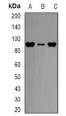a00917 cpt1a primary antiboties wb testing 1