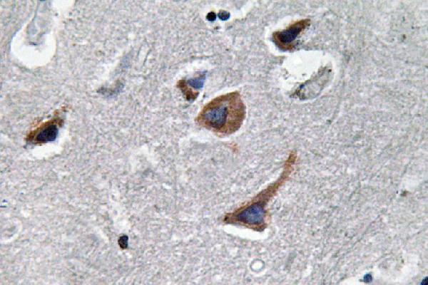 Immunohistochemistry analysis of IL-12A antibody in paraffin-embedded human brain tissue