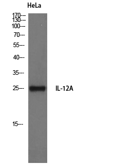 Western Blot (WB) analysis of HeLa cells using IL-12A Polyclonal antibody