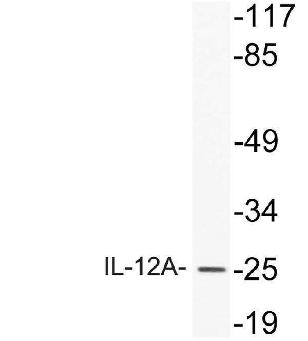 Western blot analysis of lysate from HeLa cells, using IL-12A antibody