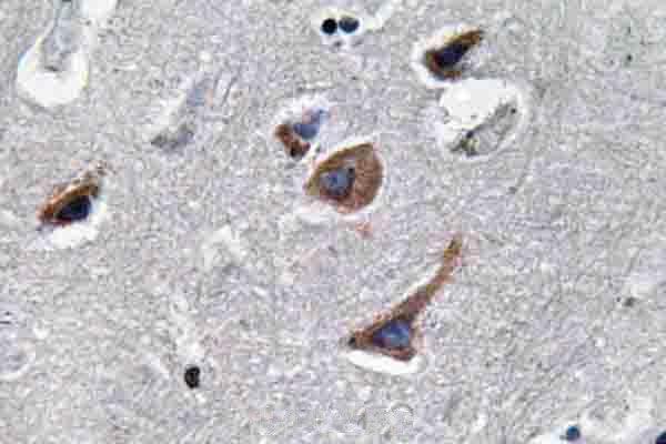 a00918t65 il12a primary antiboties ihc testing 2