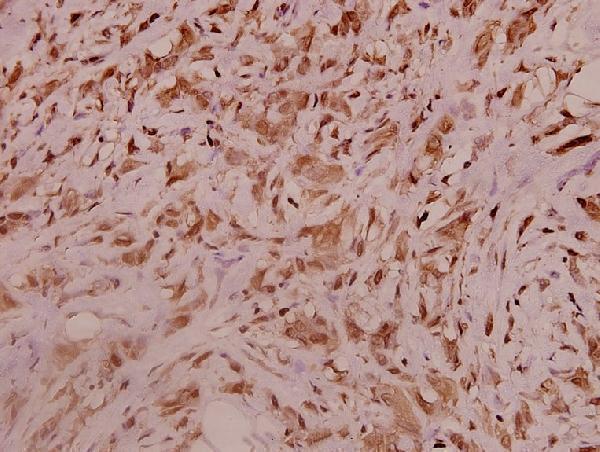a00920 2 scn9a primary antiboties ihc testing 2