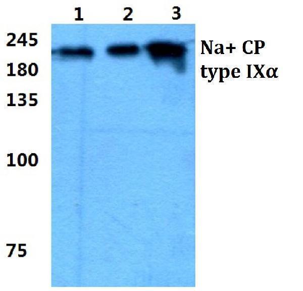 a00920 3 scn9a primary antiboties wb testing 1