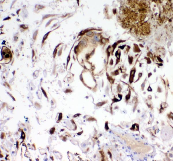  IHC analysis of IGFBP1 using anti-IGFBP1 antibody (A00922)