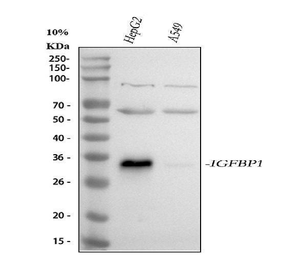  Western blot analysis of IGFBP1 using anti-IGFBP1 antibody (A00922)