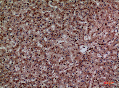 a00923 1 ceacam1 primary antibodies ihc testing 1