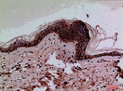 a00923 1 ceacam1 primary antibodies ihc testing 3