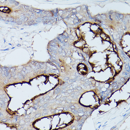 a00923 ceacam1 primary antiboties ihc testing 3