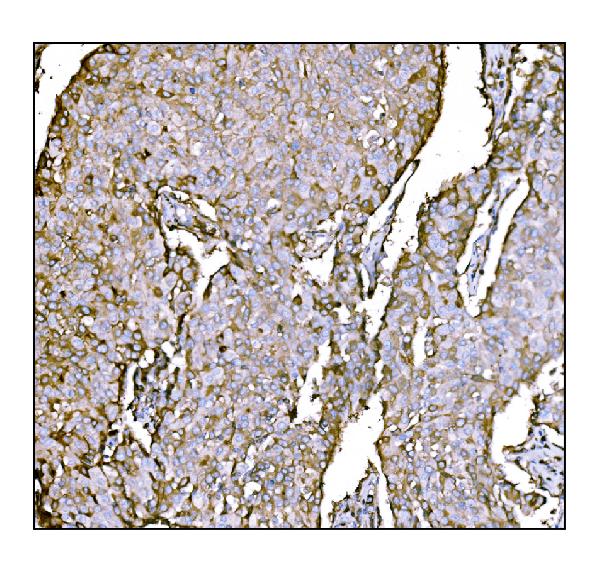 AntiHCCS Antibody Picoband™ Bosterbio