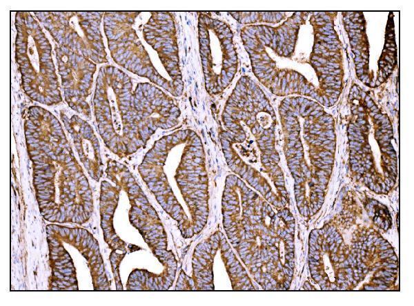 a00924 2 hccs primary antibodies ihc testing 6