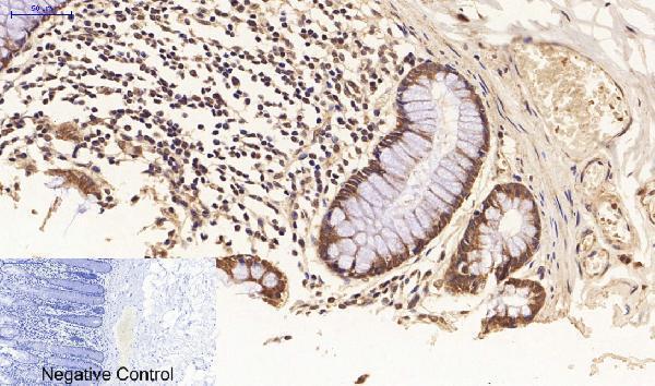 Immunohistochemistry validation of FASLG using Anti-FAS-L FASLG Antibody (A00925-1)
