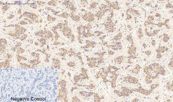 Immunohistochemistry validation of FASLG using Anti-FAS-L FASLG Antibody (A00925-1)