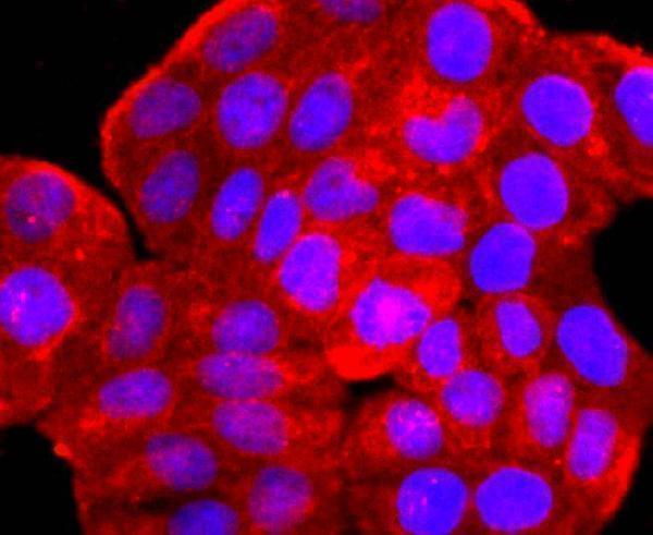 ICC staining ARF6 in Hela cells (red)
