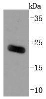 Western blot analysis of ARF6 on human liver lysates using anti-ARF6 antibody at 1/1,000 dilution