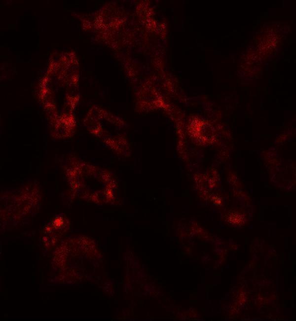 Immunofluorescence of ARF6 in human kidney tissue with ARF6 antibody at 20 μg/mL