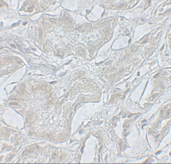 Immunohistochemistry of ARF6 in human kidney tissue with ARF6 antibody at 5 μg/mL