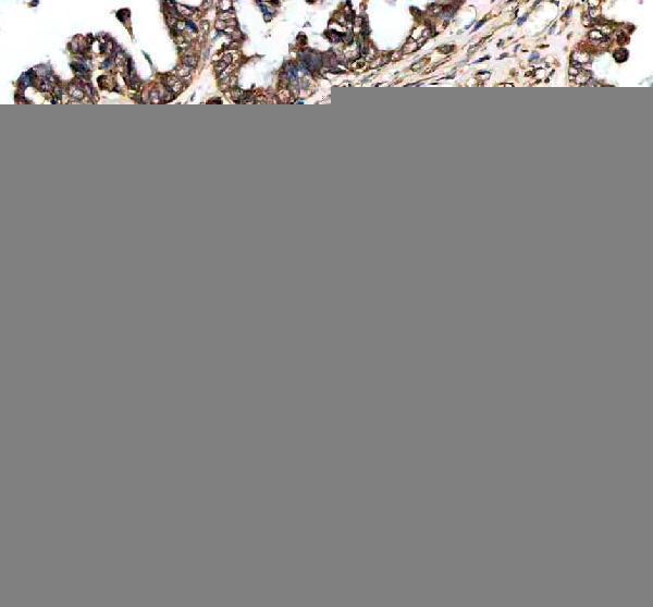 IHC analysis of GSS using anti-GSS antibody (A00928-3)