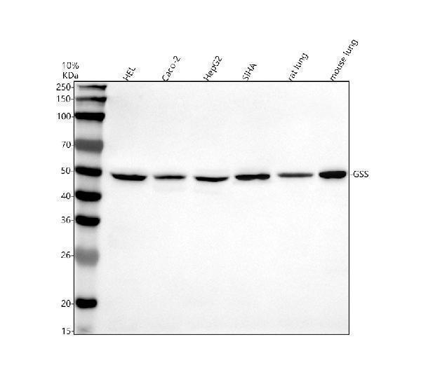 Western blot analysis of GSS using anti-GSS antibody (A00928-3)