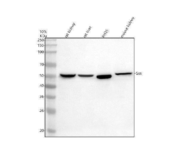 Western blot analysis of GSS using anti-GSS antibody (A00928-4)