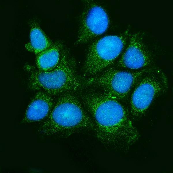 a00929 3 map3k5 primary antibodies if testing 4