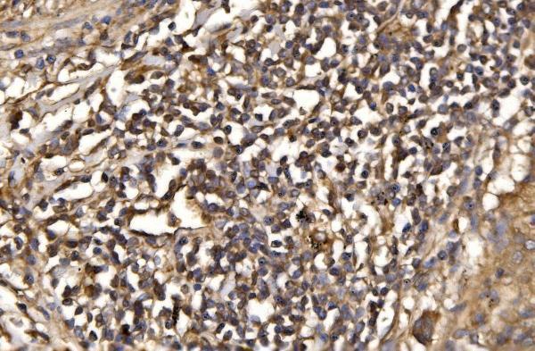  IHC analysis of ASK1/MAP3K5 using anti-ASK1/MAP3K5 antibody (A00929-3)