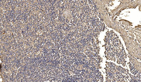  IHC analysis of ASK1/MAP3K5 using anti-ASK1/MAP3K5 antibody (A00929-3)