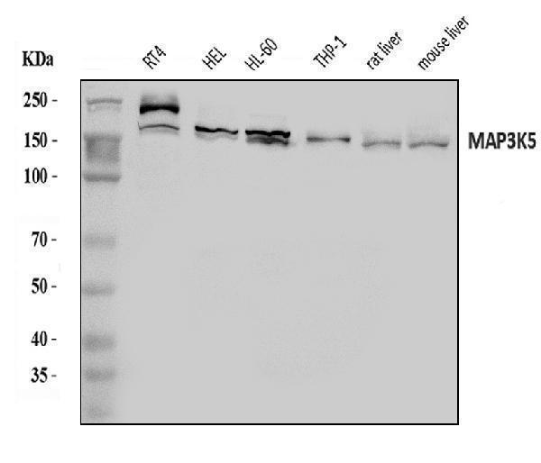  Western blot analysis of ASK1/MAP3K5 using anti-ASK1/MAP3K5 antibody (A00929-3)