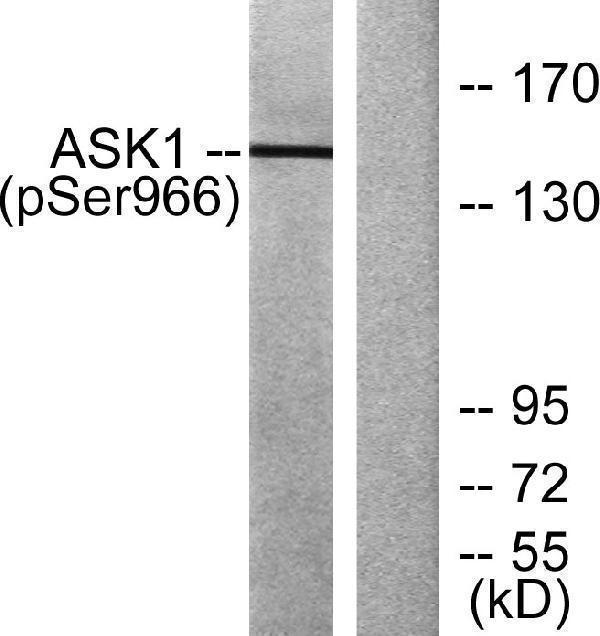 Western blot analysis of lysates from 293 cells treated with TNF (20ng/ml)+calyculinA (50nM) 15