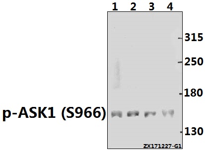 Western blot (WB) analysis of p-ASK1 (S966) pAb at 1:500 dilution
Lane1:H1792 whole cell lysate(40ug)
Lane2:K562 whole cell lysate(40ug)
Lane3:MCF-7 whole cell lysate(40ug)
Lane4:HEK293T whole cell lysate(40ug)