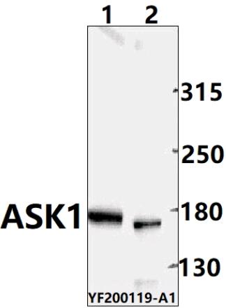 Western blot (WB) analysis of MAP3K5 pAb at 1:500 dilution
Lane1:PC3 whole cell lysate(40ug)
Lane2:H9C2 whole cell lysate(40ug)