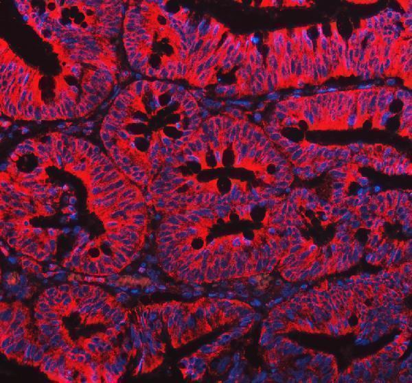 a00930 1 eml4 primary antibodies if testing 1