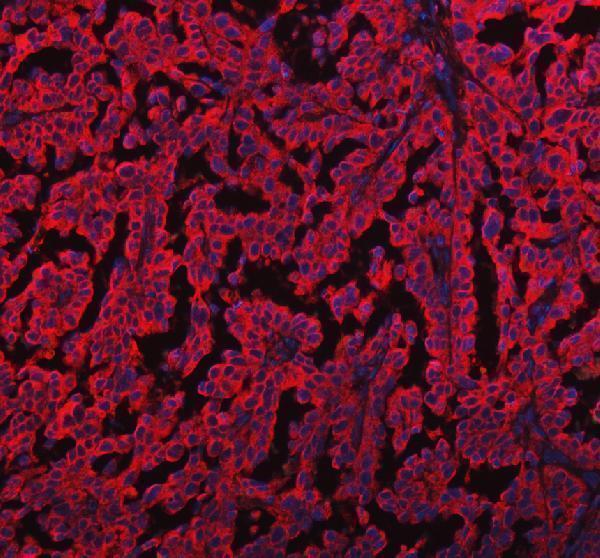 a00930 1 eml4 primary antibodies if testing 2