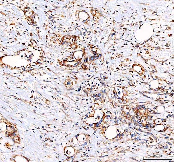 a00930 1 eml4 primary antibodies ihc testing 2