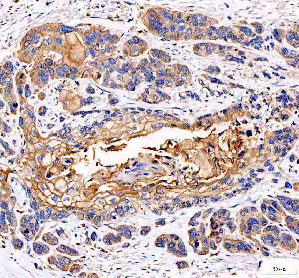 a00930 1 eml4 primary antibodies ihc testing 3