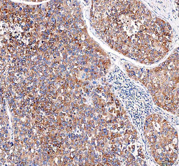 a00930 1 eml4 primary antibodies ihc testing 4