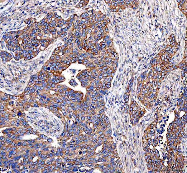 a00930 1 eml4 primary antibodies ihc testing 5