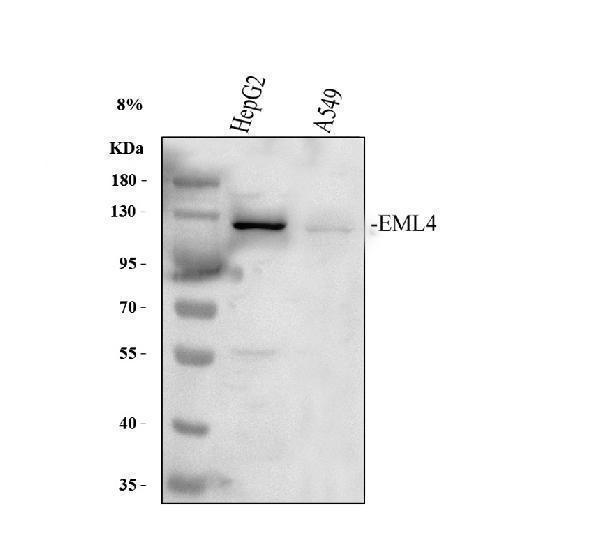 a00930 1 eml4 primary antibodies wb testing 1_1
