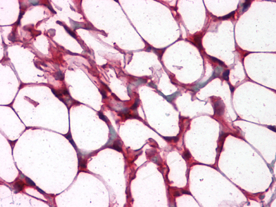 Immunohistochemistry analysis of paraffin-embedded human Colon, Adipocytes tissues with AEC staining using ETS1 Monoclonal Antibody