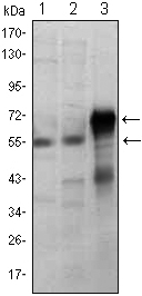 Western Blot analysis using ETS1 Monoclonal Antibody against Jurkat (1), HepG2 (2) and ETS1-hIgGFc transfected HEK293 (3) cell lysate