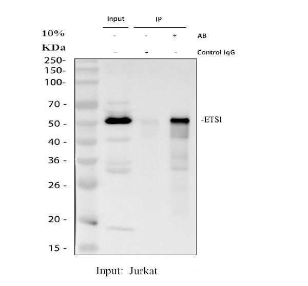 Immunoprecipitating ETS1 in Jurkat whole cell lysate