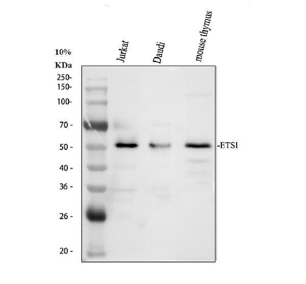 Western blot analysis of ETS1 using anti-ETS1 antibody (A00931-2)