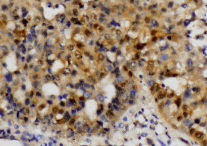a00931 3 ets1 primary antiboties ihc testing 2