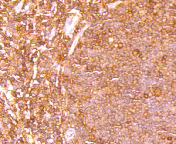 a00931 4 ets1 primary antiboties ihc testing 2