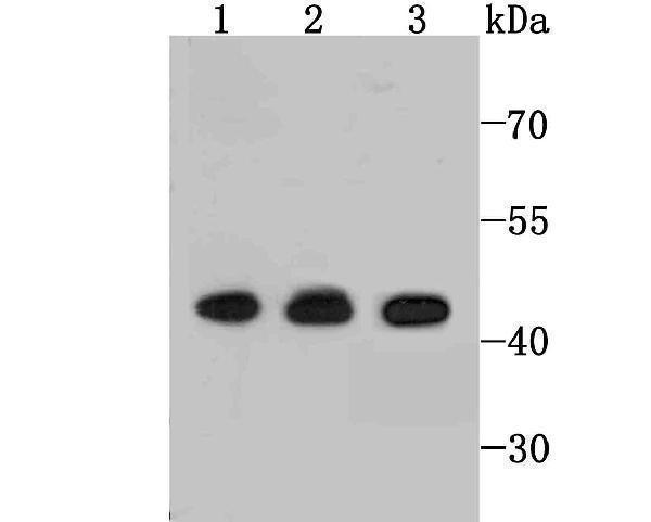 a00931 4 ets1 primary antiboties wb testing 1