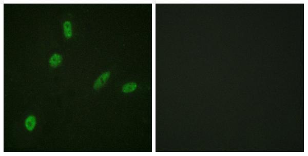 a00931 ets1 primary antibodies if testing 1