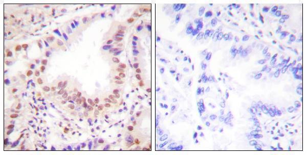 a00931 ets1 primary antibodies ihc testing 4
