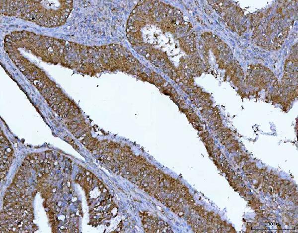  IHC analysis of PGP using anti-PGP antibody (A00932-1)